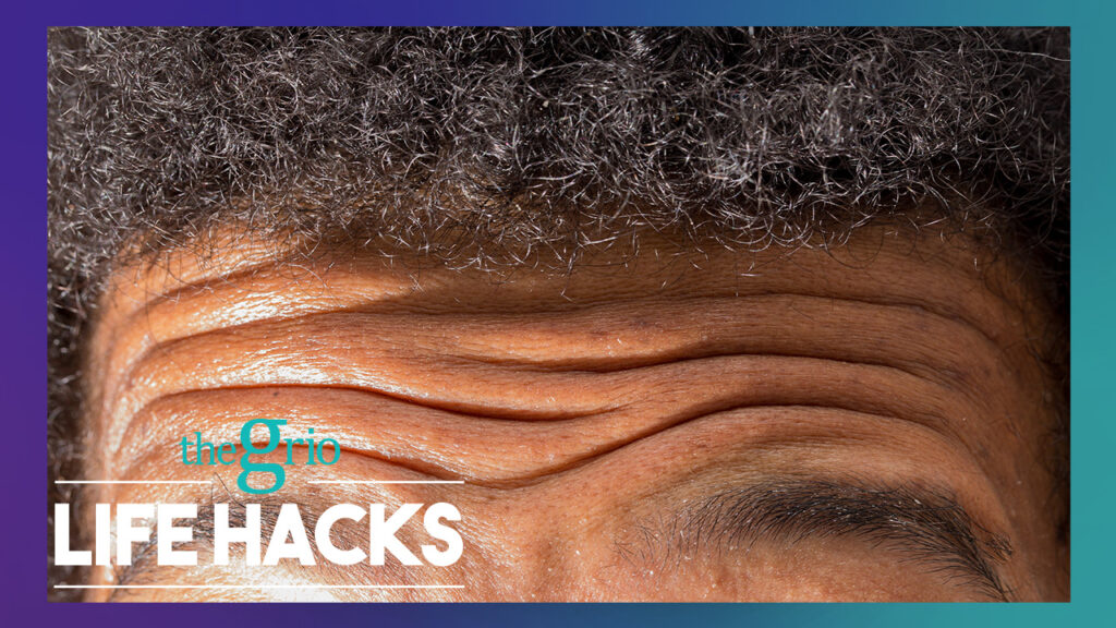 Watch: The process behind hairline lowering surgery | Life Hacks