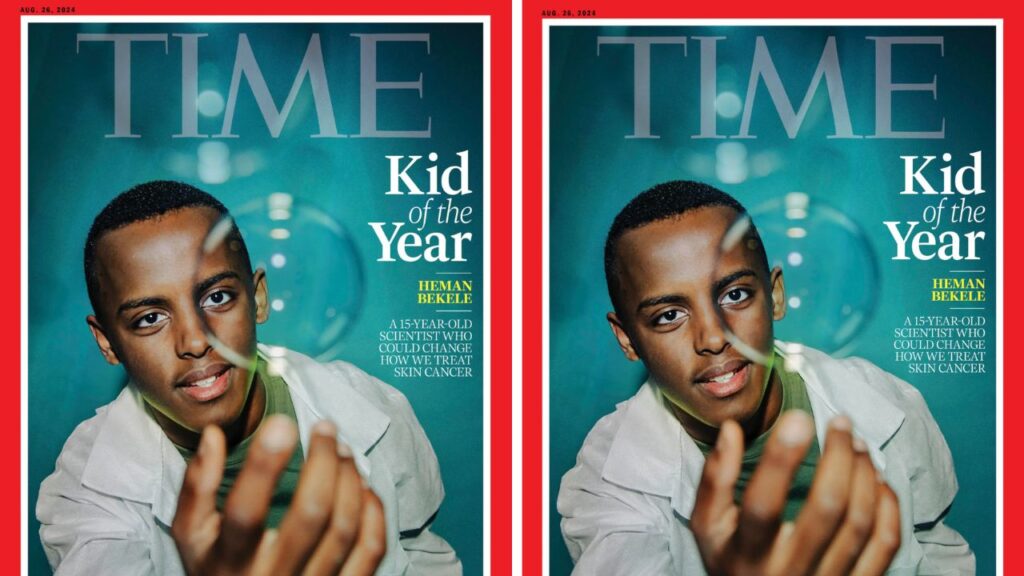 Time Kid of the Year, 2024 Time Kid of the Year, Black Time Kid of the Year, Heman Bekele, Kevionn Woodward, skin cancer, skin cancer soap, skin cancer prevention, theGrio.com