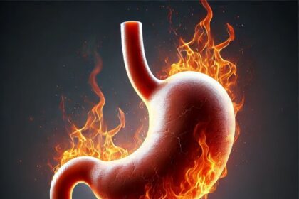 5 ways to avoid gastritis triggers